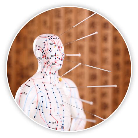 acupuncture baguio|Top 10 Best Acupuncture Near Baguio, Benguet .